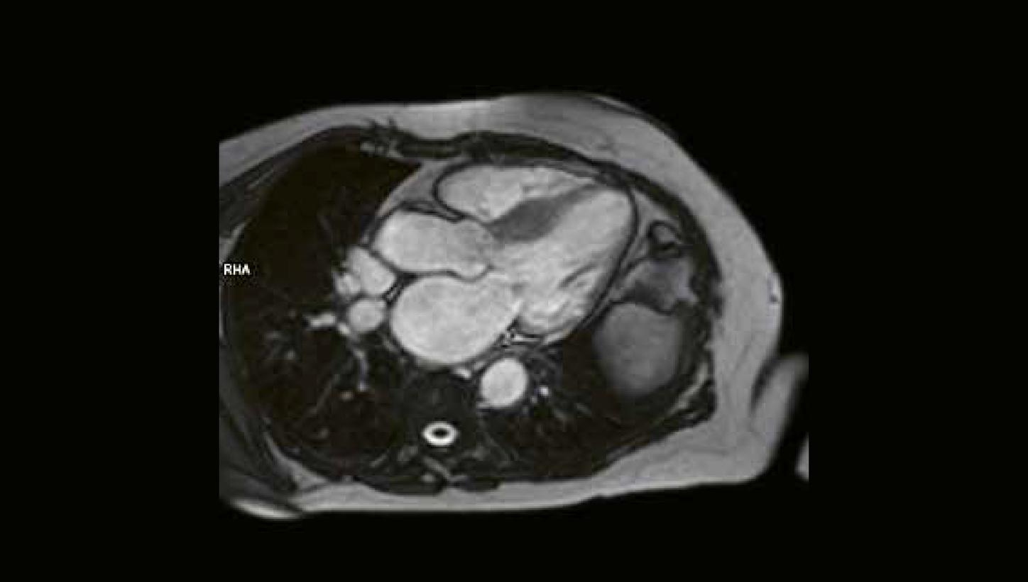 Clinical case MRI Cardiology imaging 2026