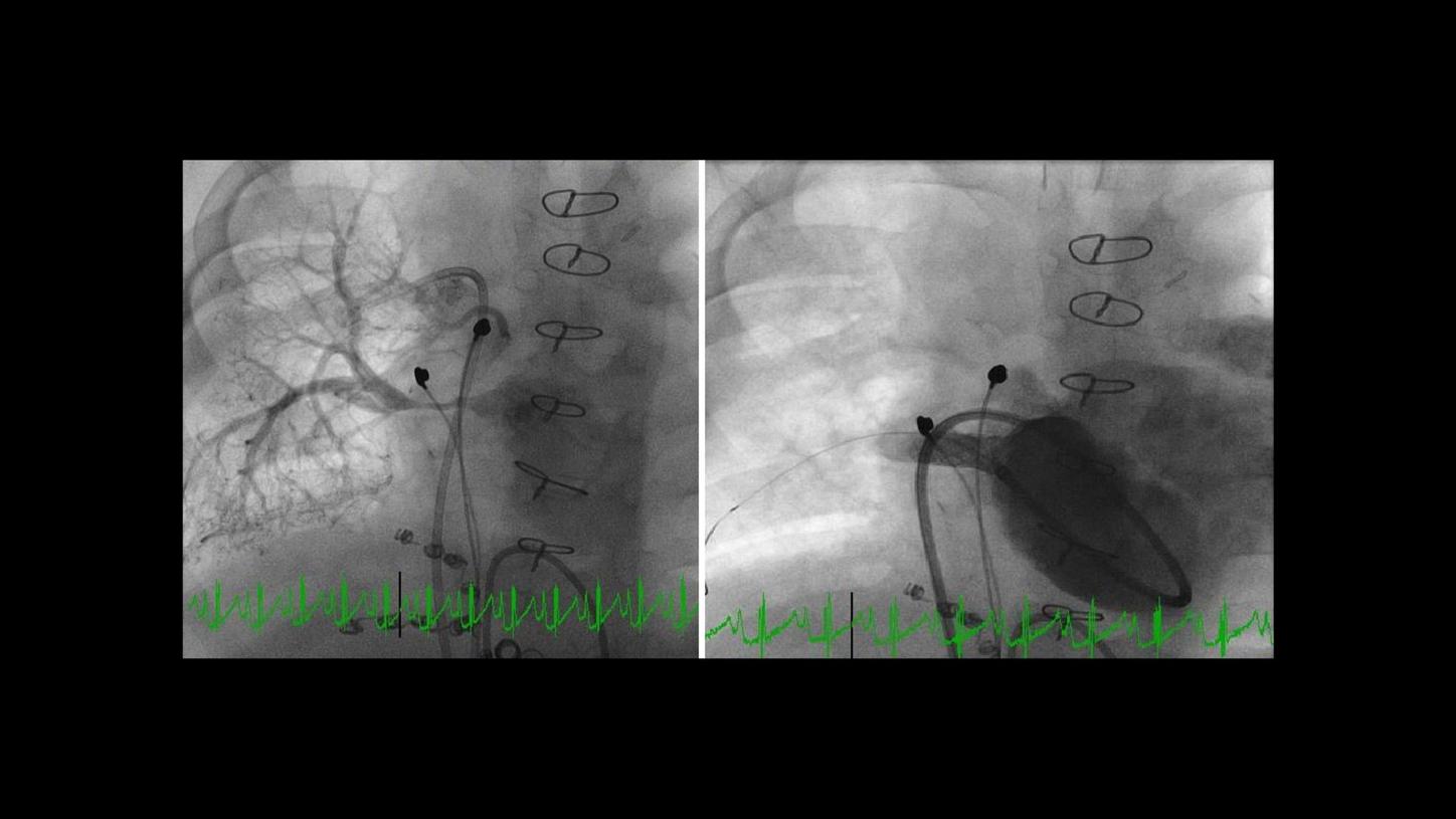 challenge of imaging small bodies