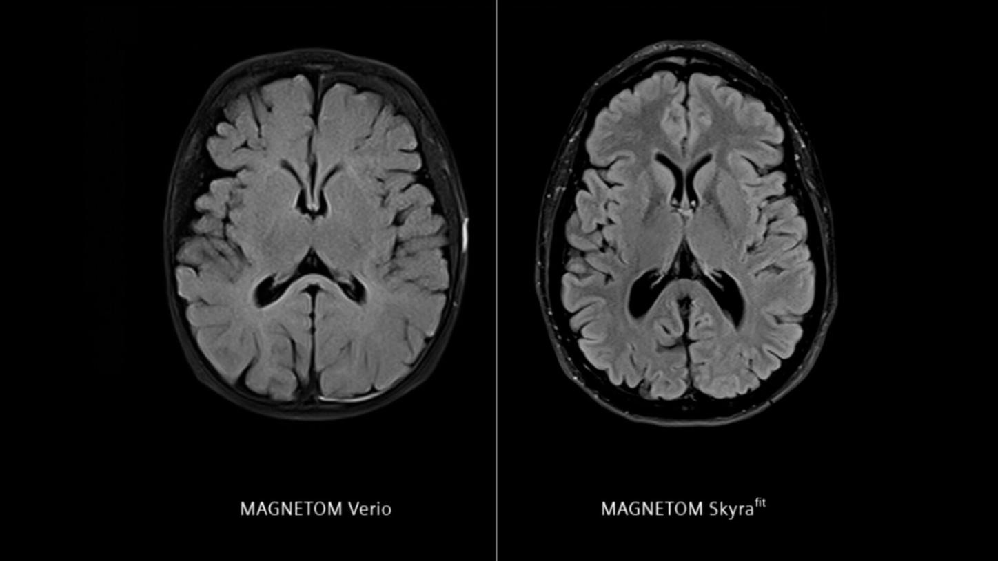 Siemens - MRI - MAGNETOM Skyra fit - Image - Neurology