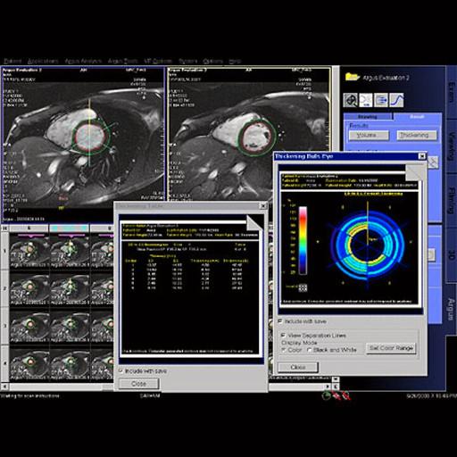 Semi-automated Argus Function cardiac output results are shown