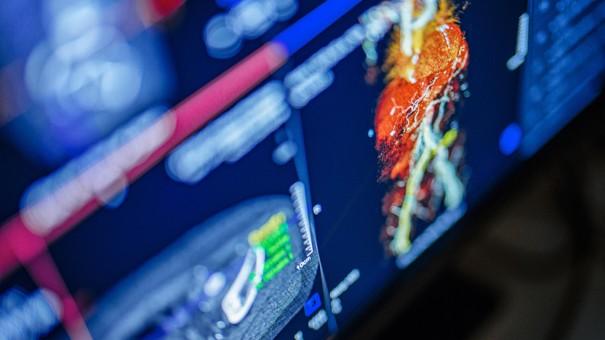 From innovation to impact: How AI elevates patient care