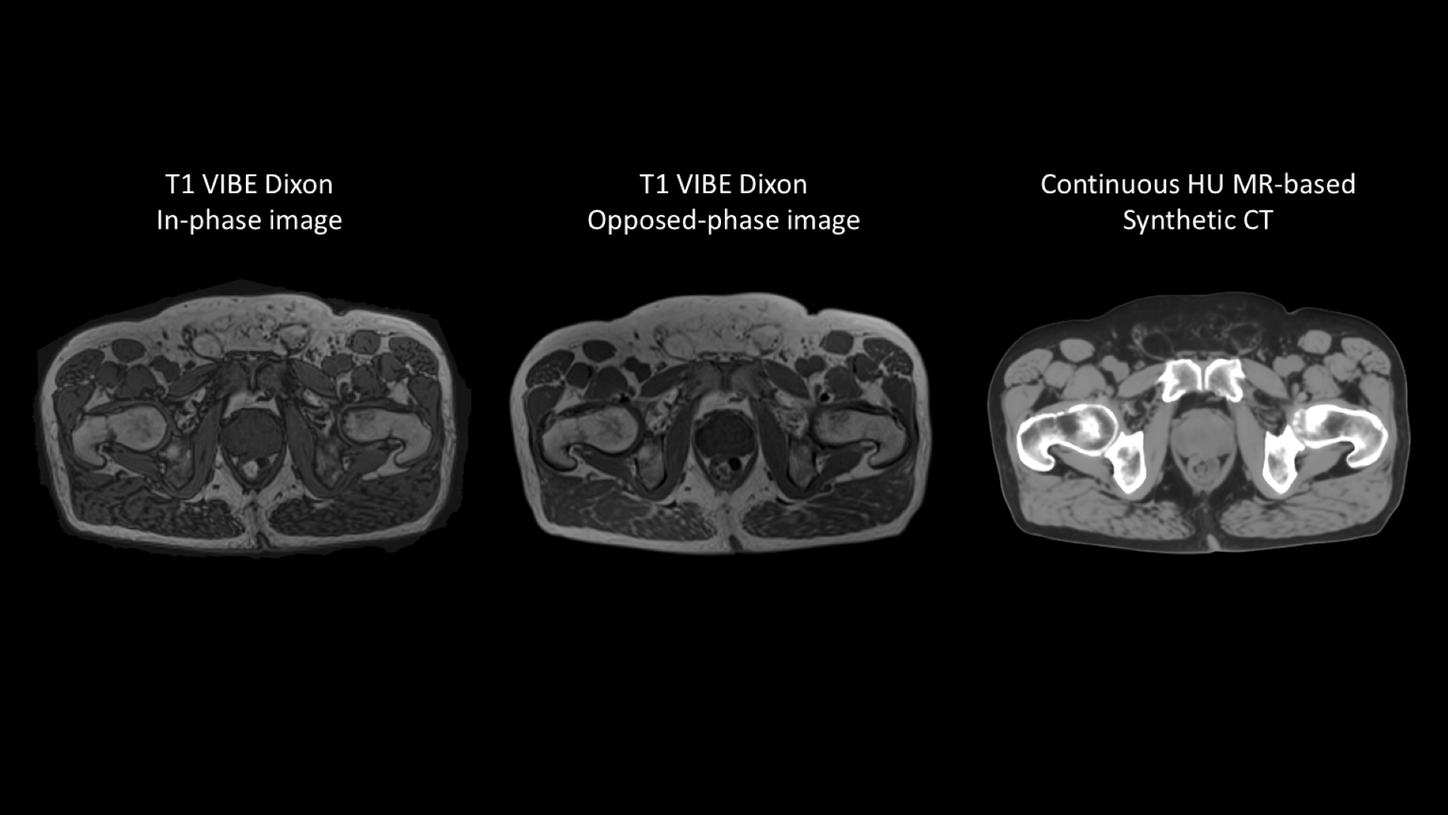 Key features of MR-based Synthetic CT