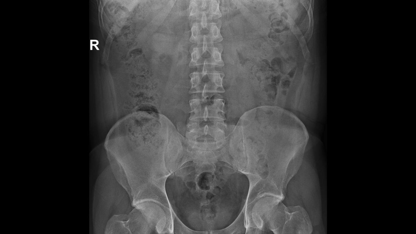 DI XP Luminos Qnamix Abdomen