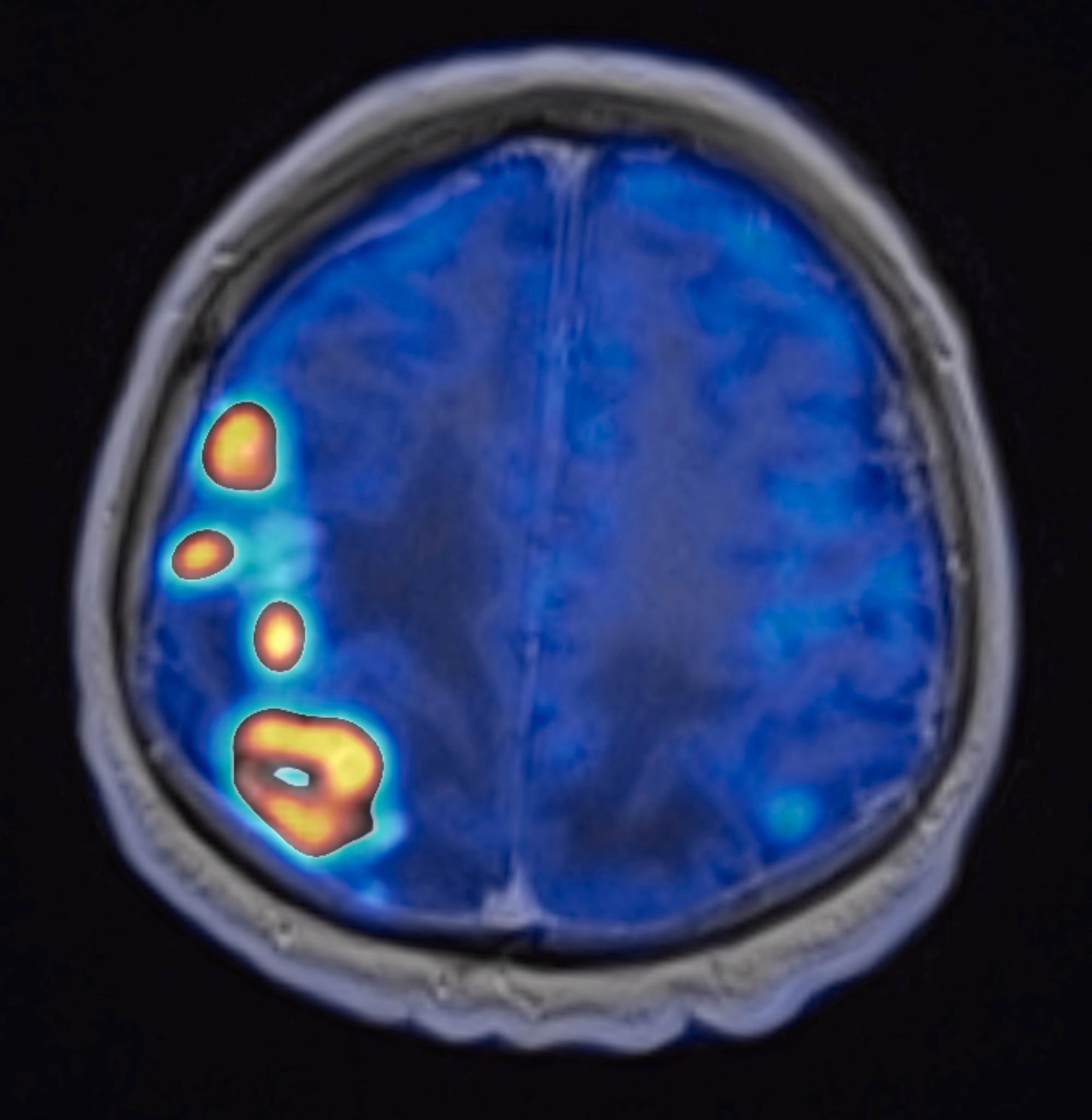 craneo-fusion-ct-scanner