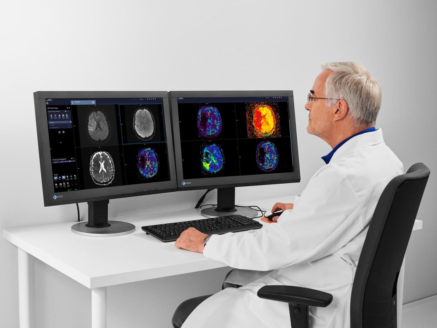 man examines neurological images