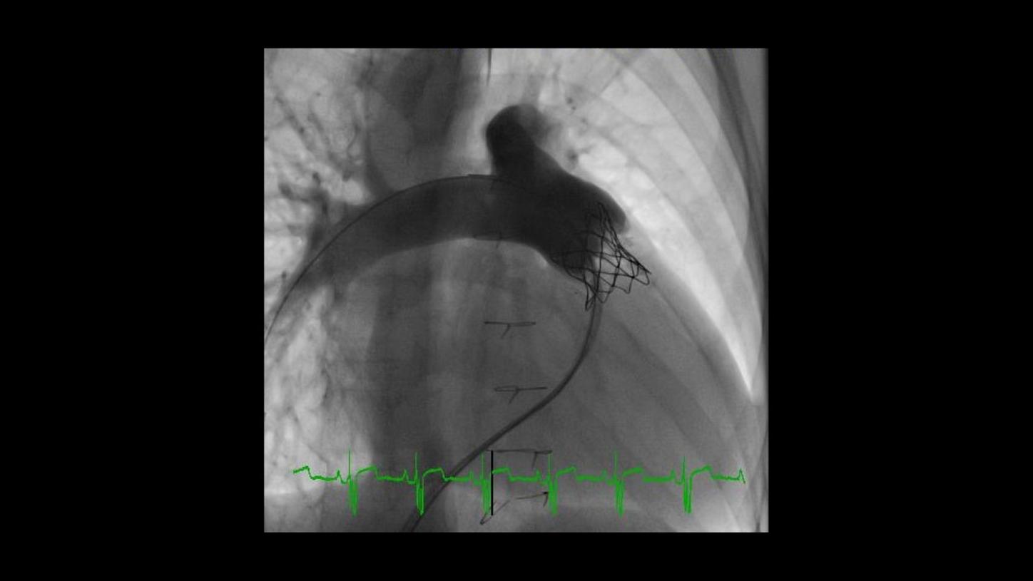 challenge of imaging small bodies