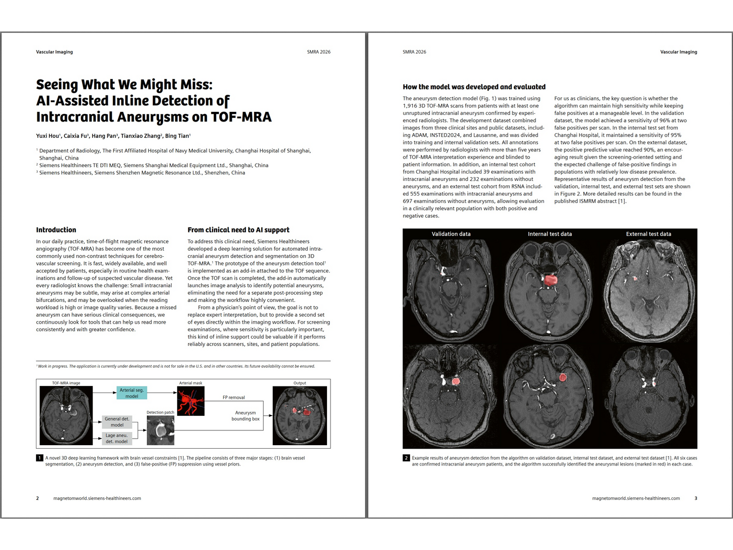 Siemens-healthineers_Magnetomworld_Bing-Tian-TOF-MRA