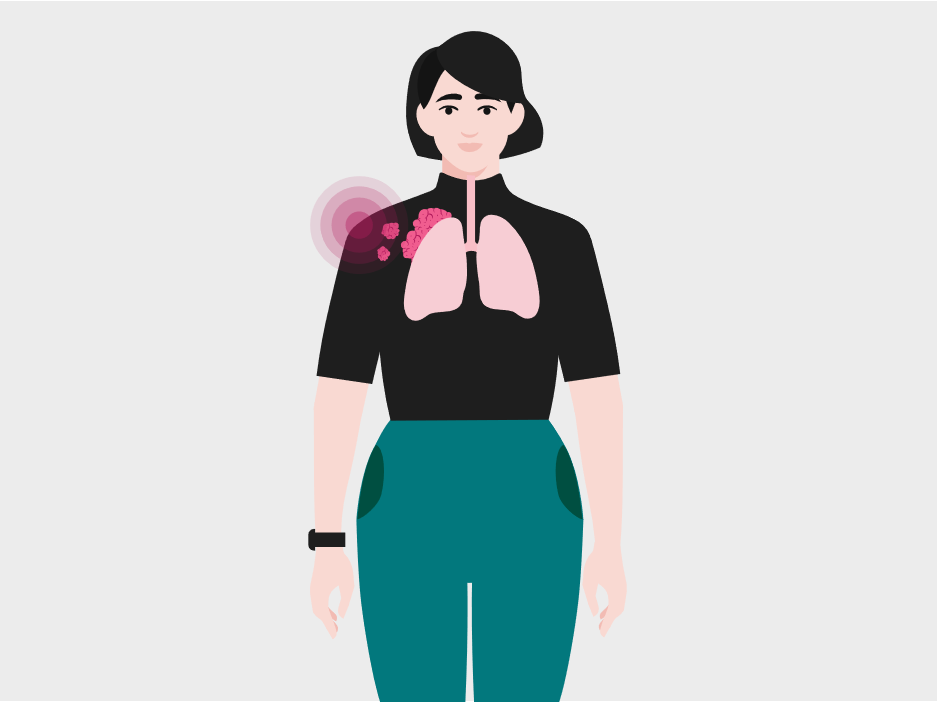 Woman and Lung Cancer