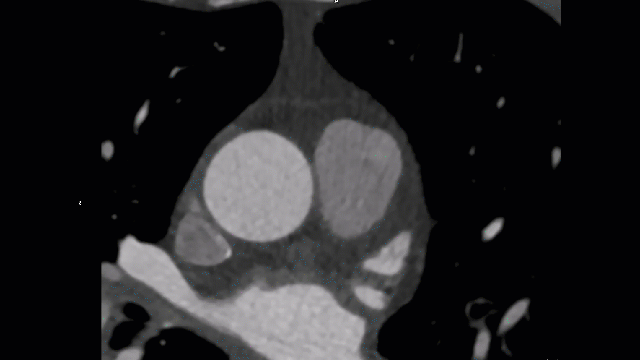 clinical_proof_3_ct