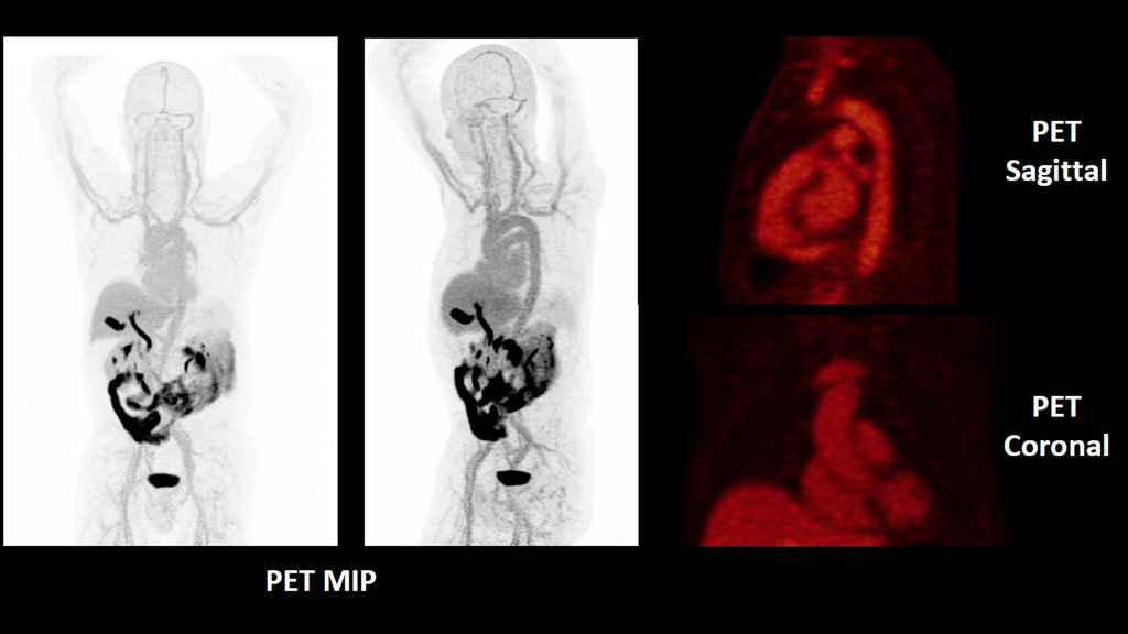Biograph Vision PET/CT - Siemens Healthineers USA