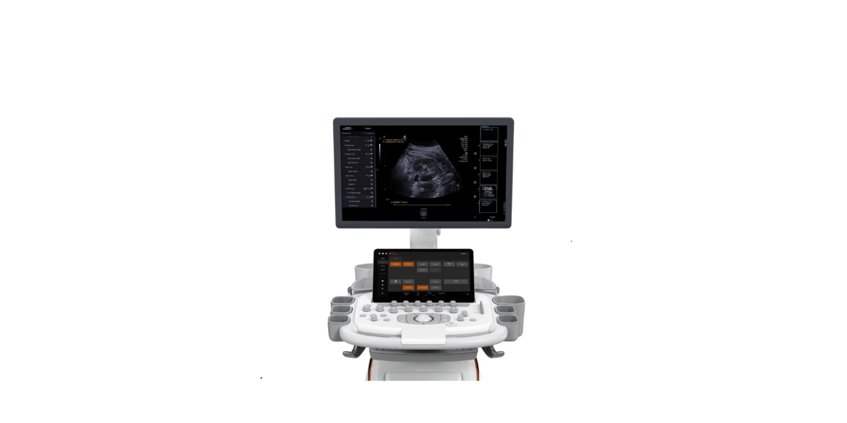 acuson sequoia 3.5 news and stories