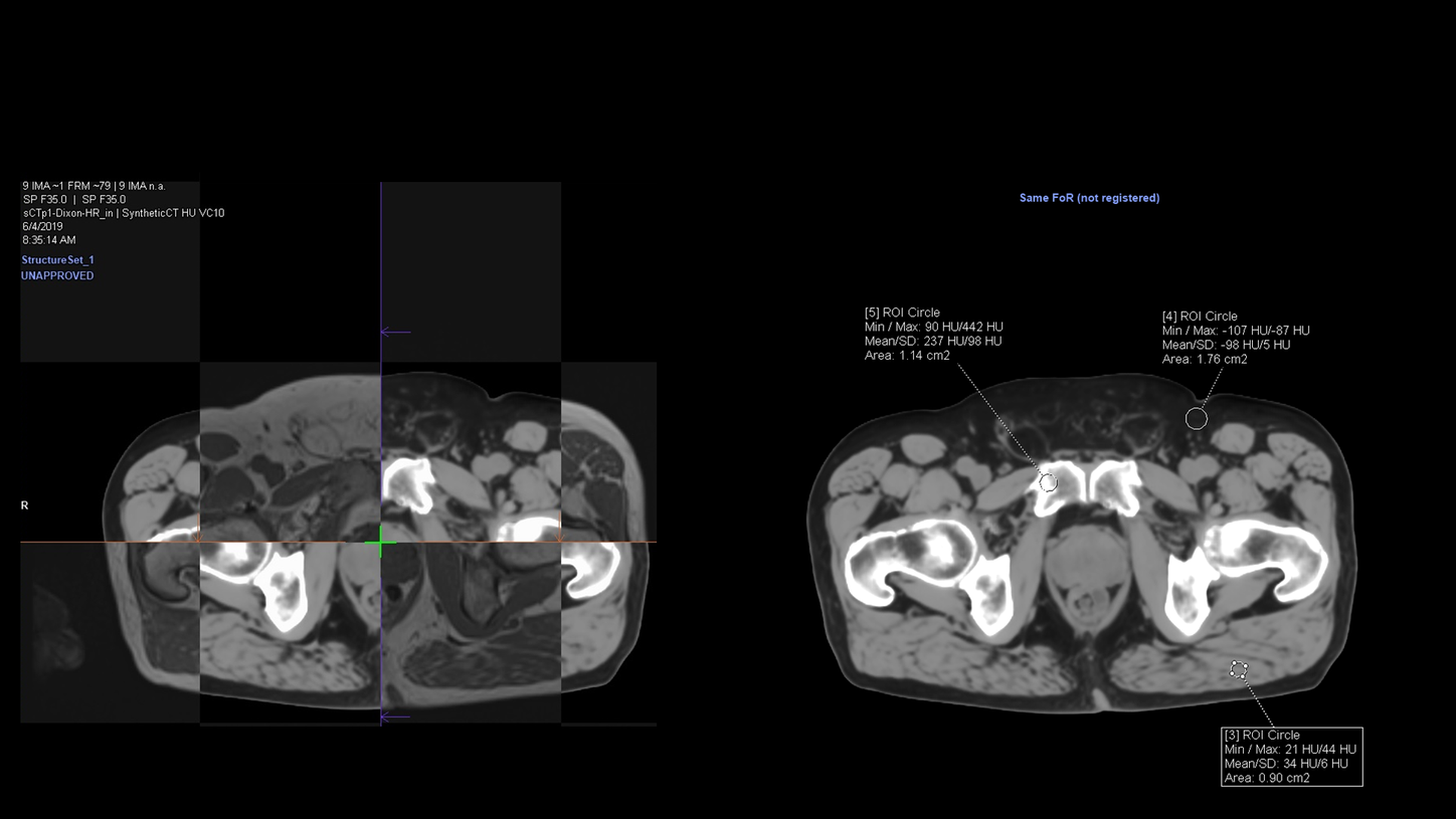 Synthetic CT Checkerboard Tool