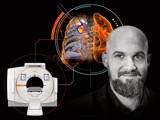 Lung cancer screening - Siemens Healthineers
