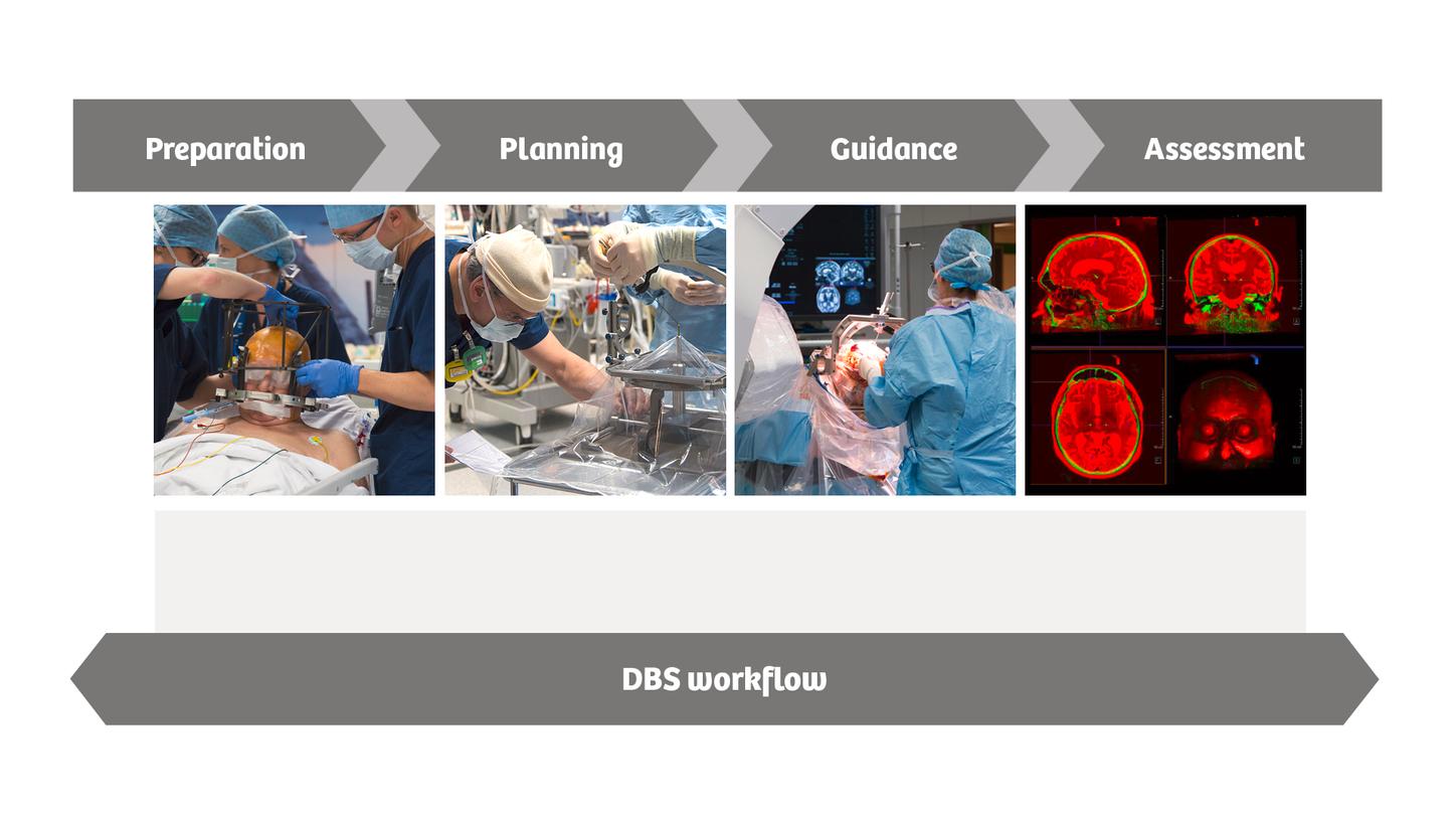 dbs workflow