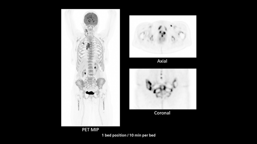Biograph Vision Quadra PET/CT Scanner - Siemens Healthineers