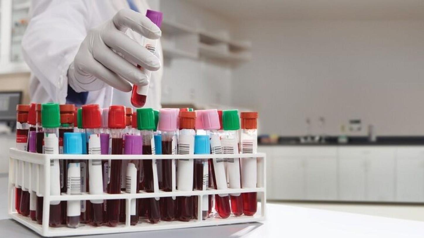 A laboratorian placing a test tube into a rack