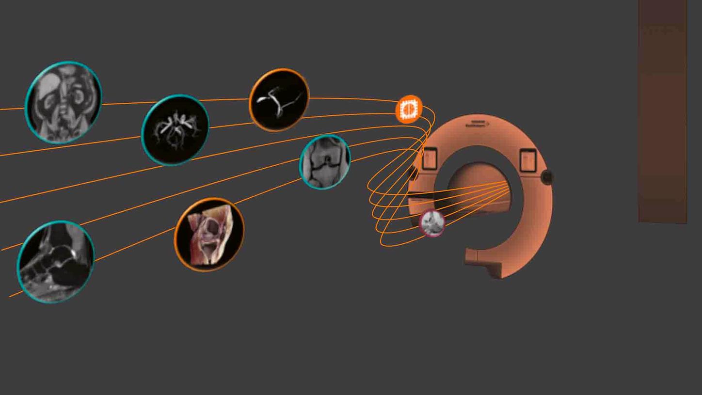 MR Image Quality and Optimization