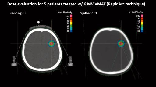 MR-only Radiotherapy Planning - Siemens Healthineers