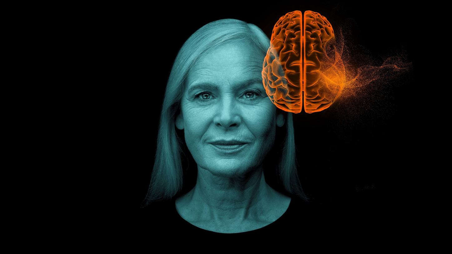 Alzheimer's disease key visual 
