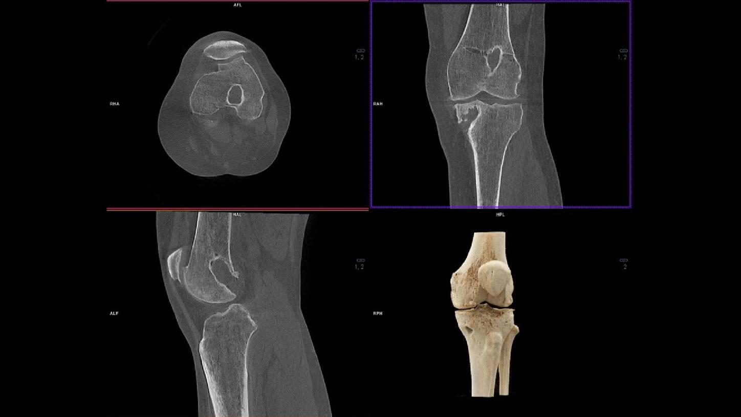 Real 3D weight-bearing imaging