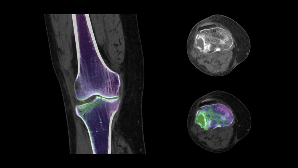 Dual Energy CT Spectral Imaging - Siemens Healthineers USA