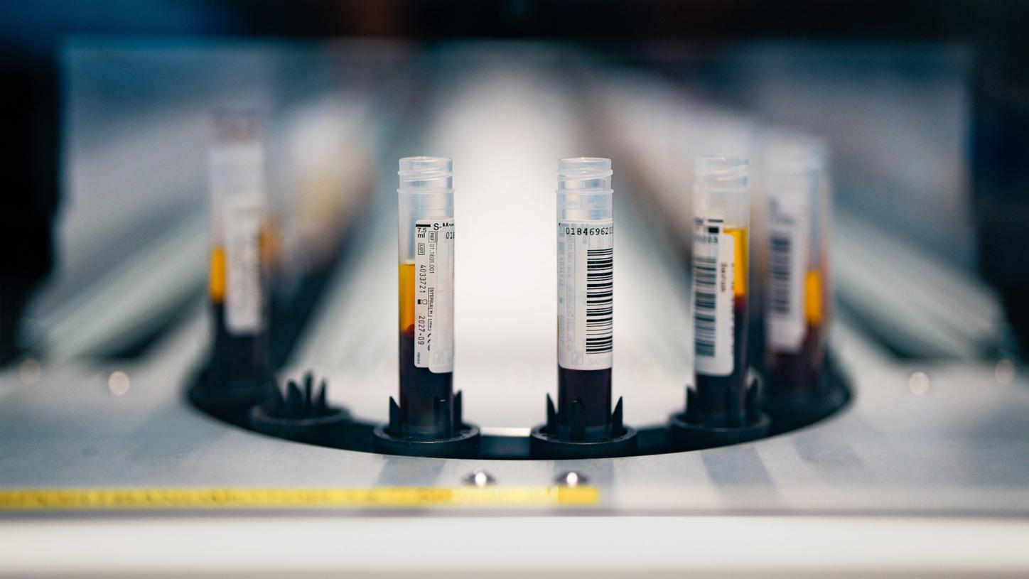 Blood sample tubes in a laboratory analyzer.