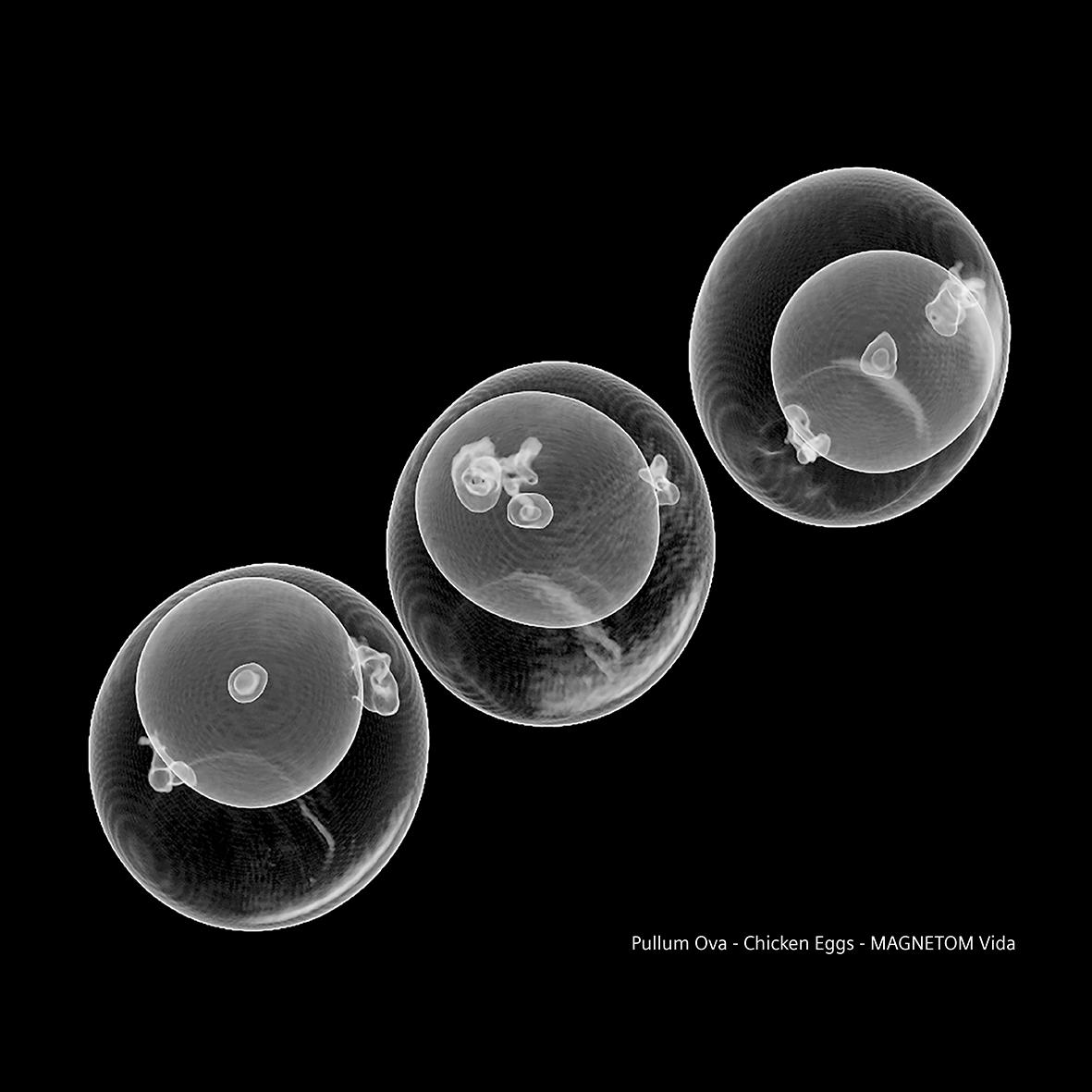 Siemens-healthineers_Magnetomworld_Chicken_Eggs_Vida