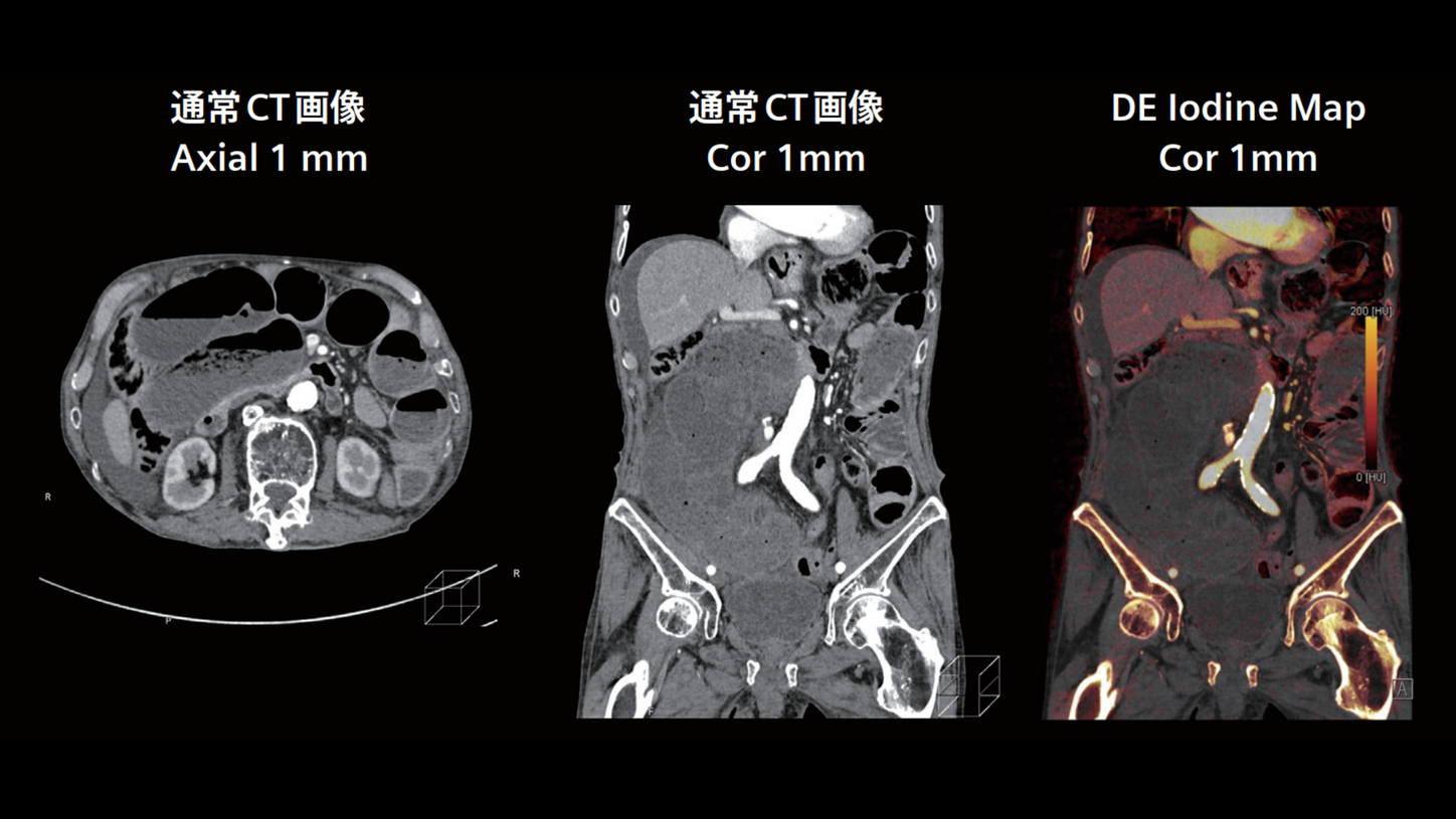 JP-CT-Pro.Pulse_CaseRport_vol.2-3