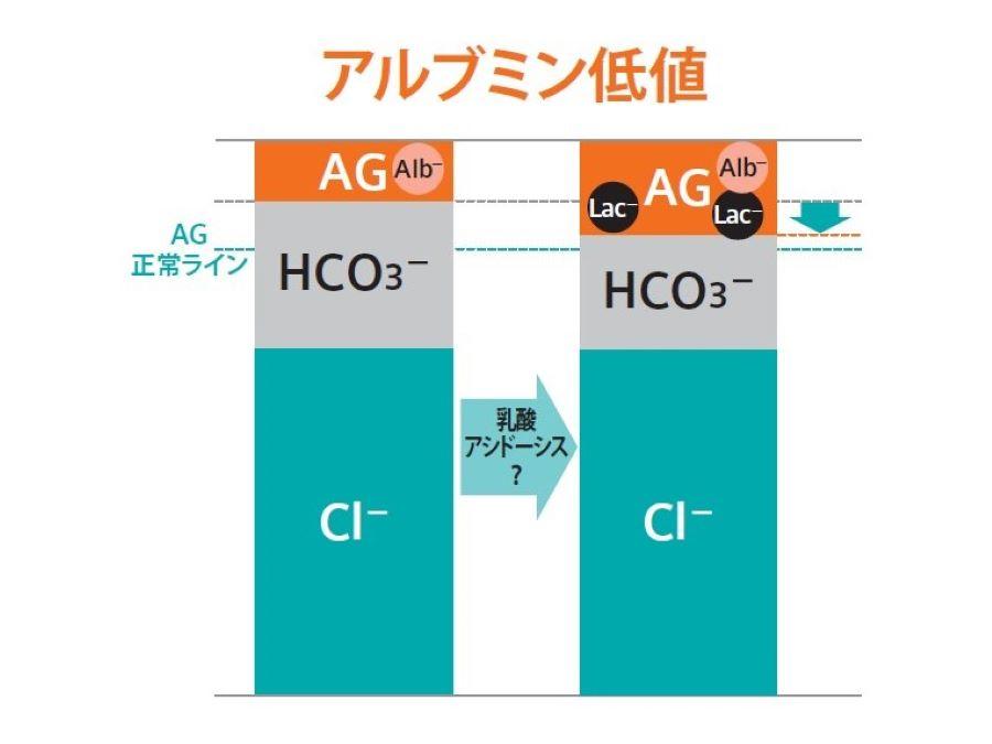 血液ガス分析かわら版⑧アルブミン低値