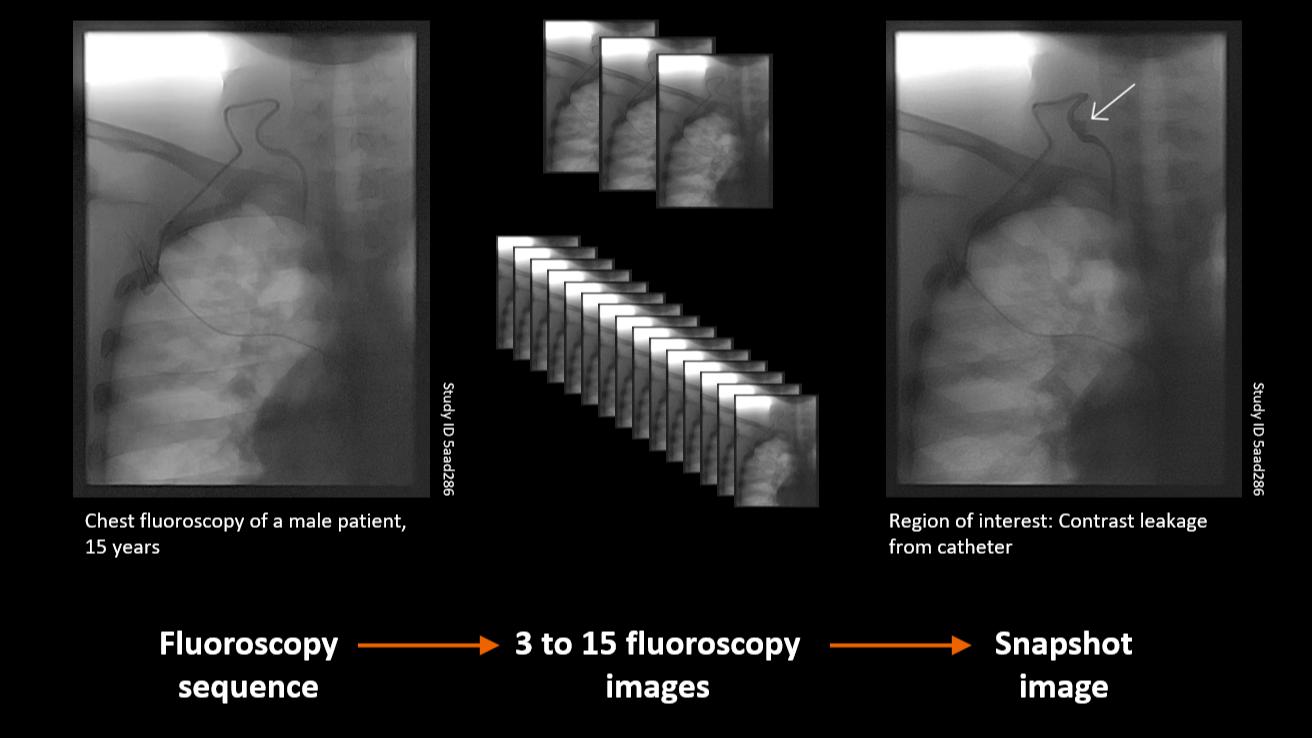 Fluoroscopy: Snapshot mode clinical workflow
