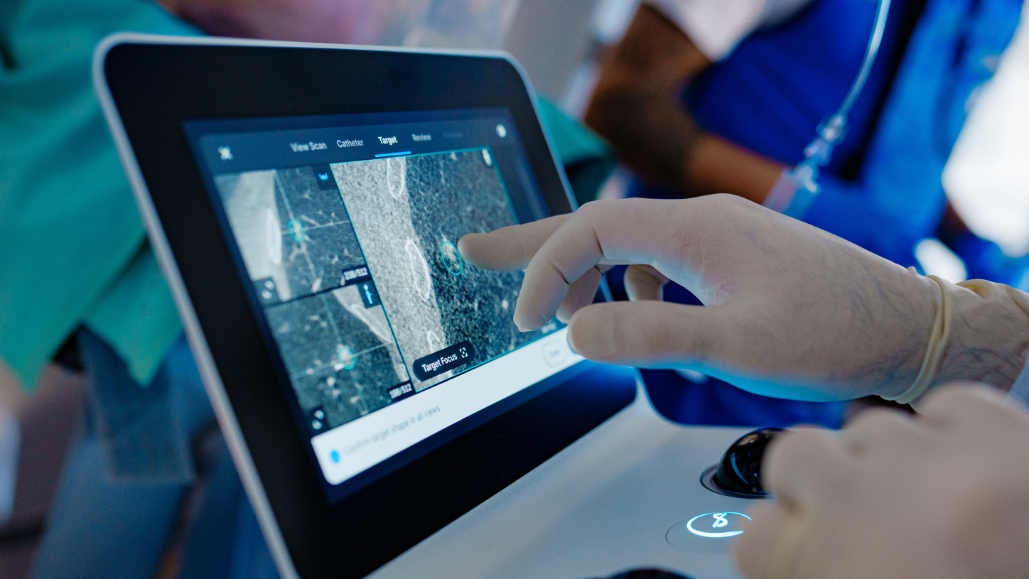 Image-guided robotic bronchoscopy with Intuitive Ion and Cios Spin, a 3D C-arm for pulmonology