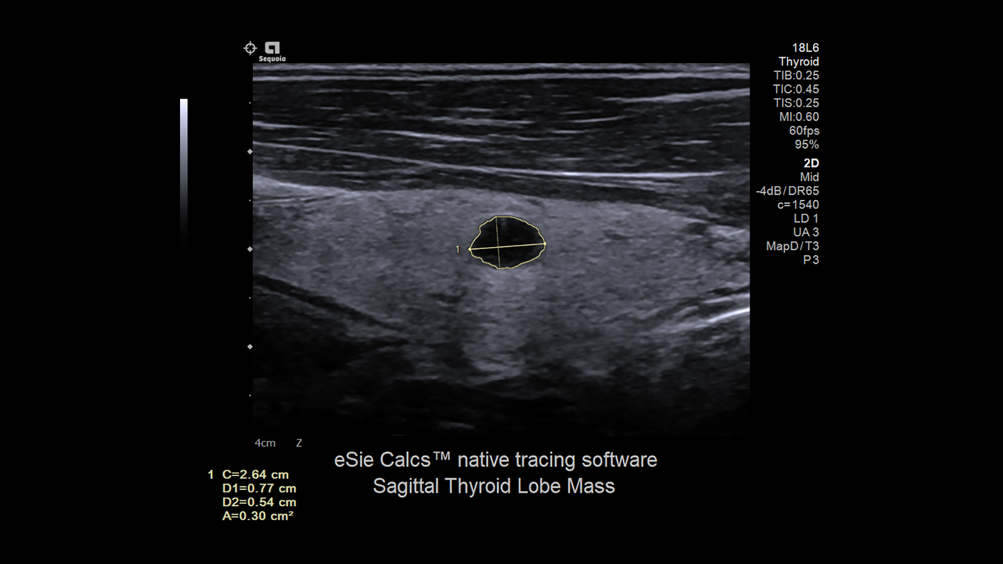 eSieCalcs Thyroid