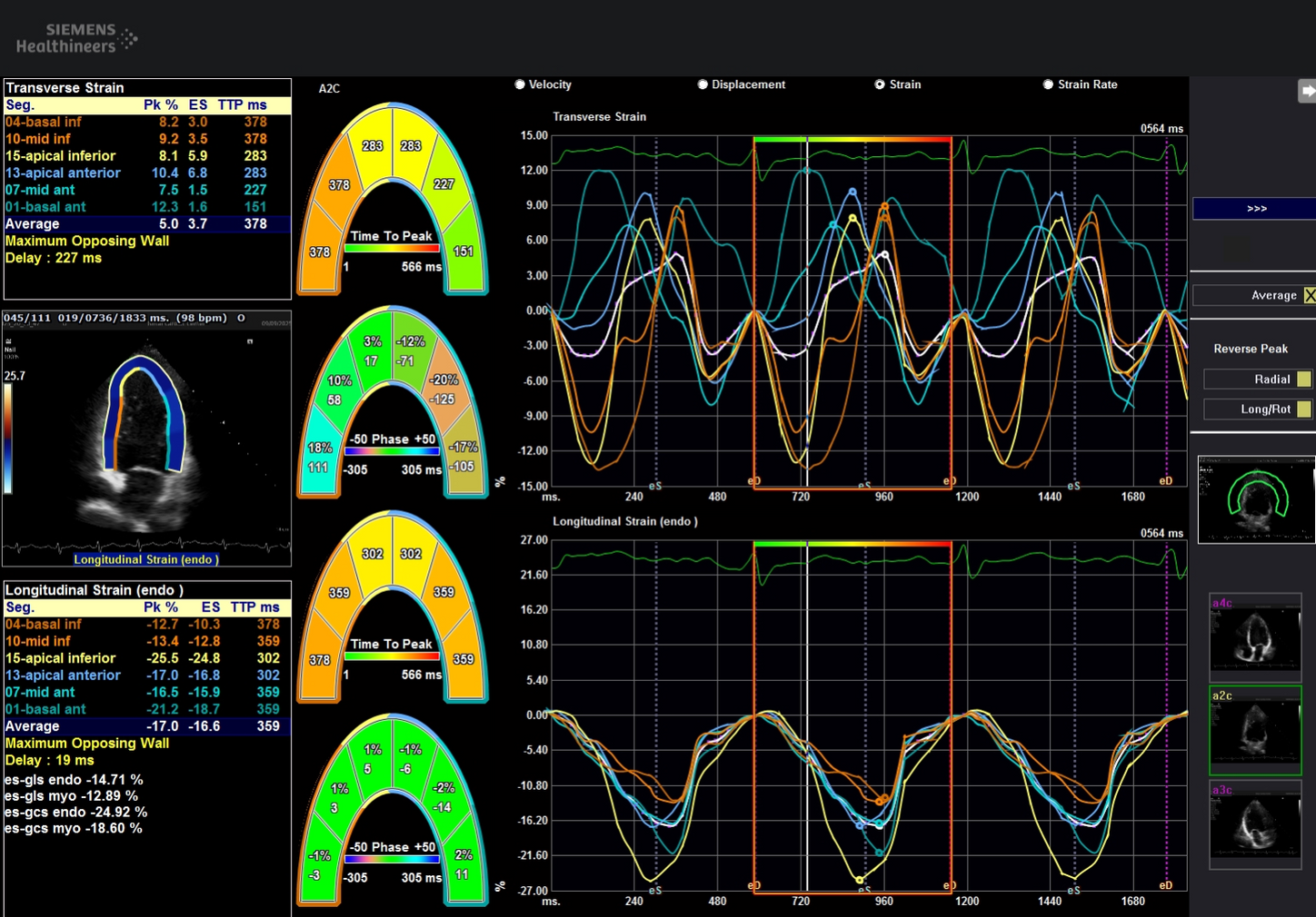 Conventional Echocardiographic Findings