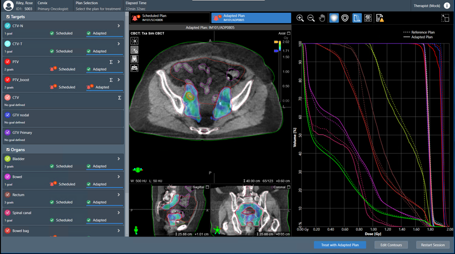 Ethos therapy - detection daily anatomy