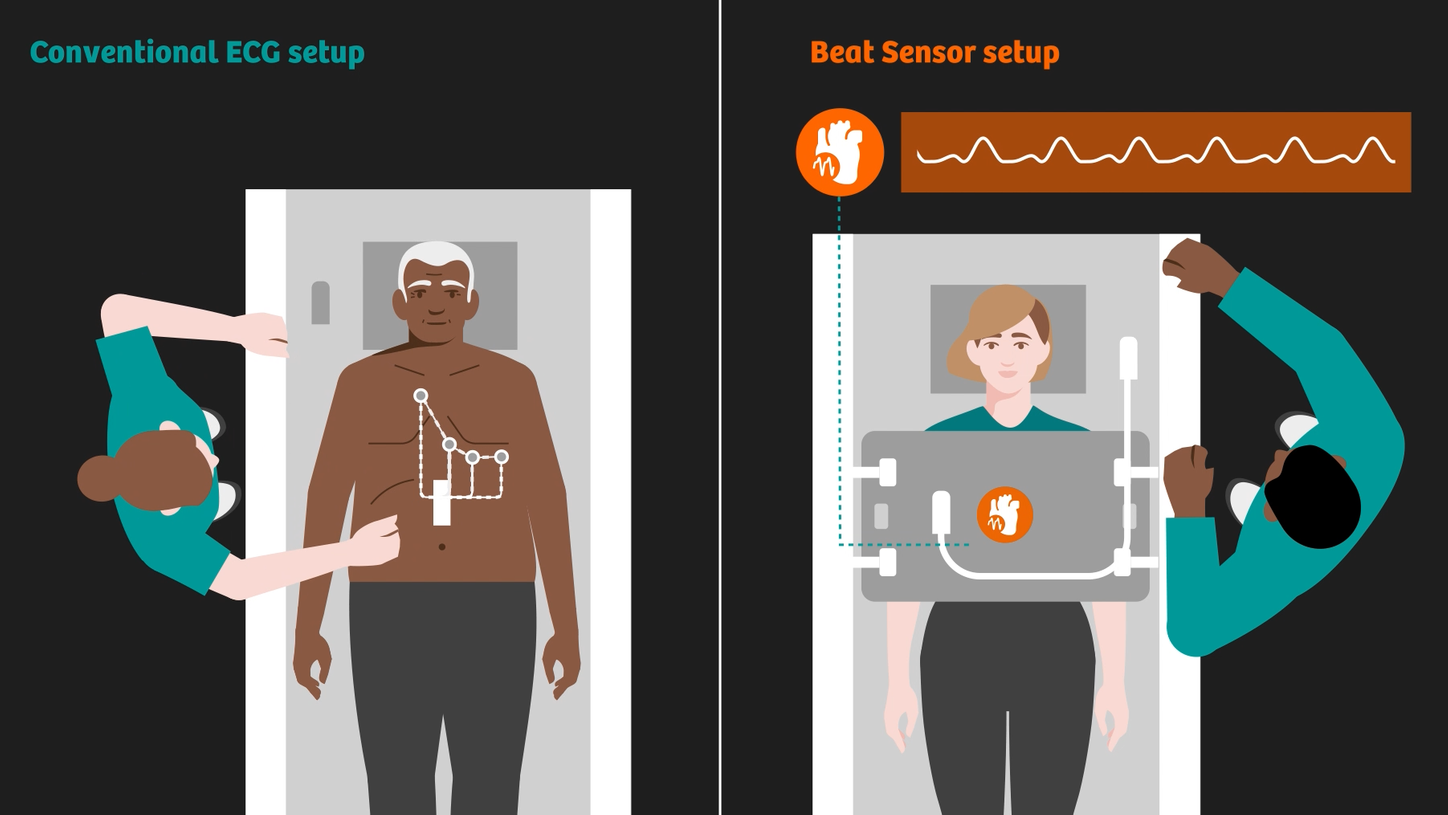 Beat Sensor comparison