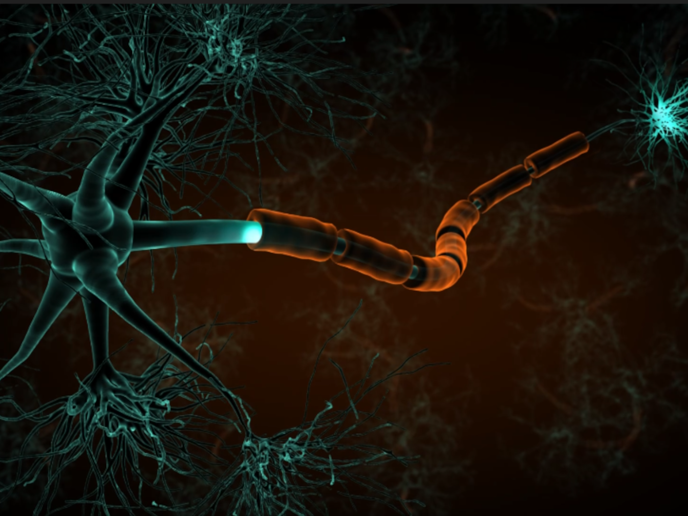 Neurofilament-Leichtketten (NfL)-Assays