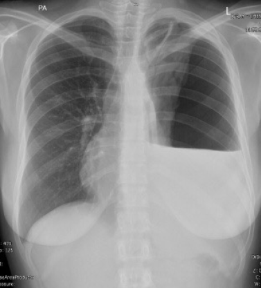 chest radiology