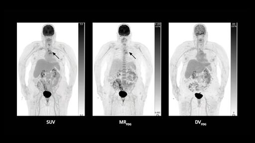Total-body multiparametric PET/CT allows clinician researchers to see ...