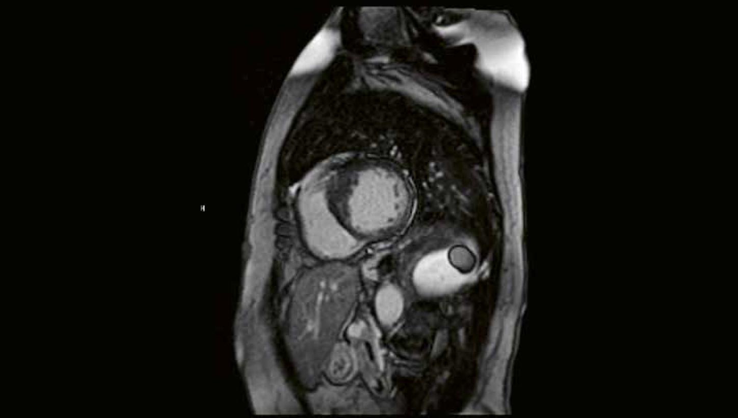 Clinical case MRI Cardiology imaging 2026