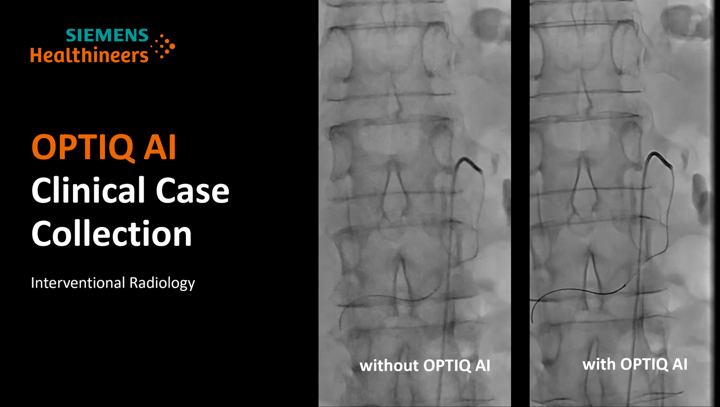 OPTIQ AI Clinical Case Collection Interventional Radiology
