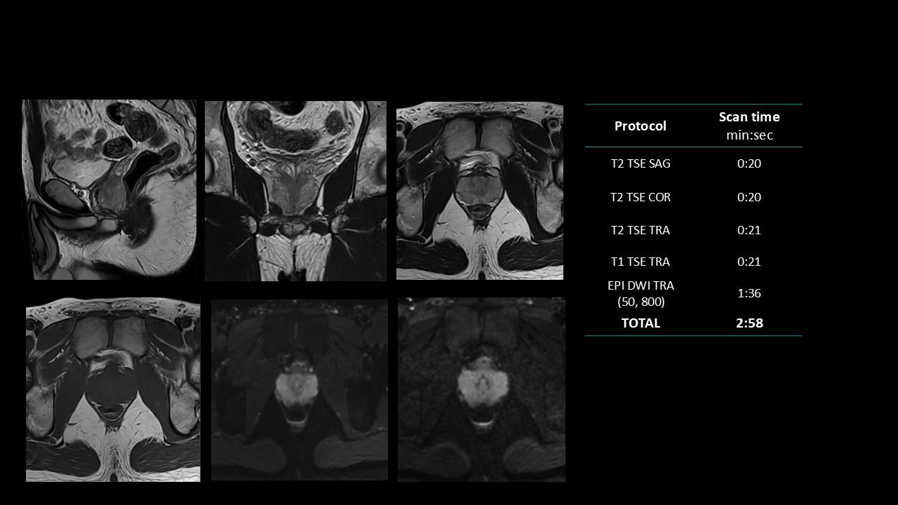siemens-healthineers_magnetomworld_Prostate-rountine