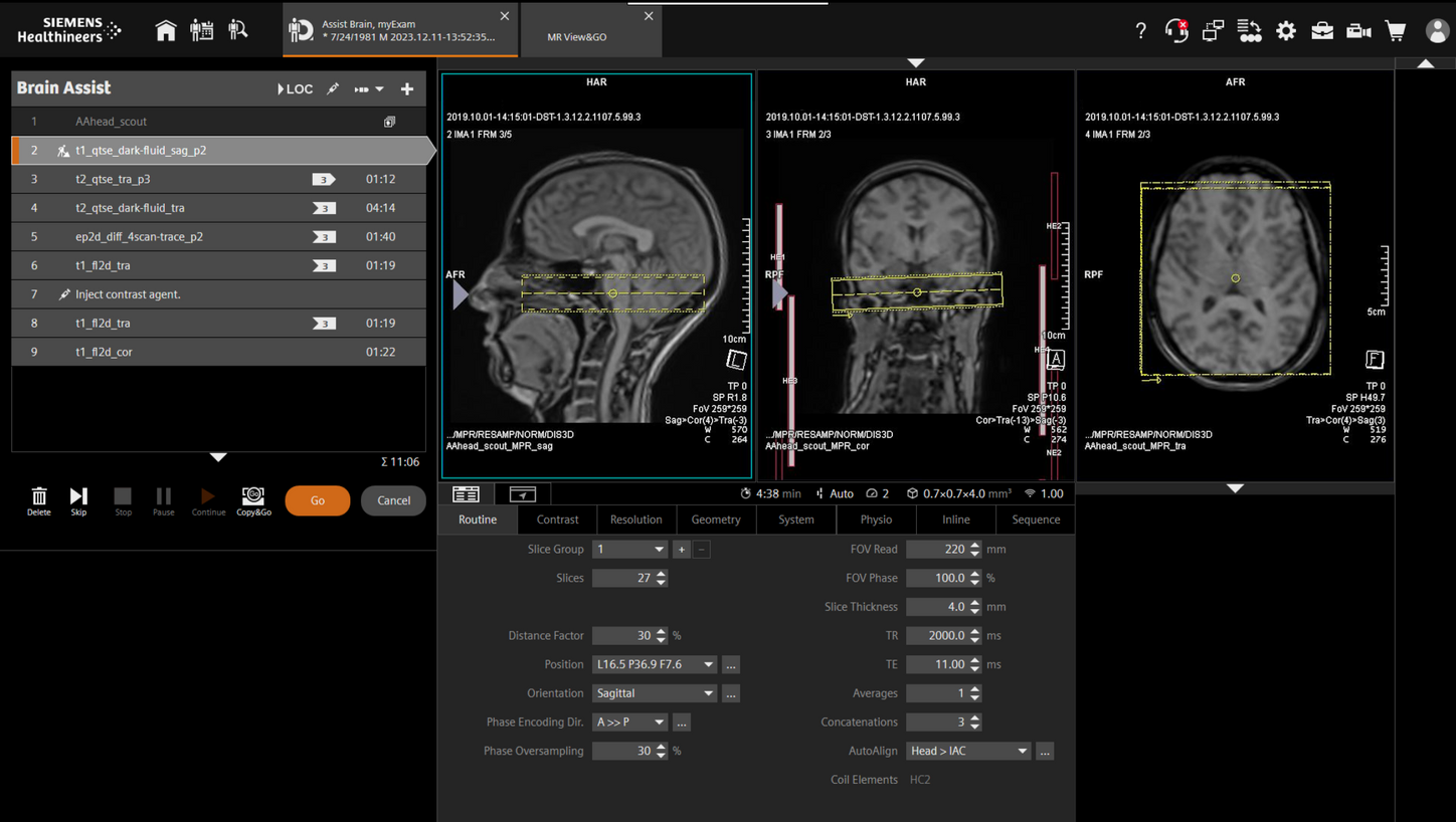 MRI Protocols