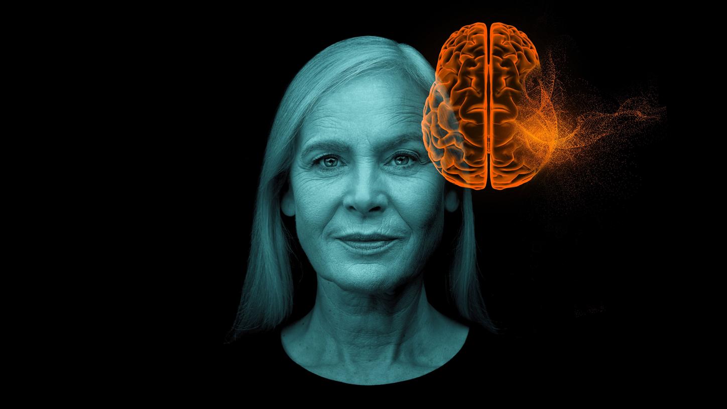Alzheimer's key visual