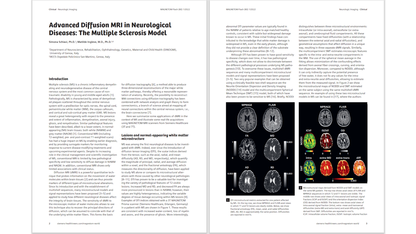 siemens-healthineers_Magnetomworld_Advanced-Diffusion-MRI