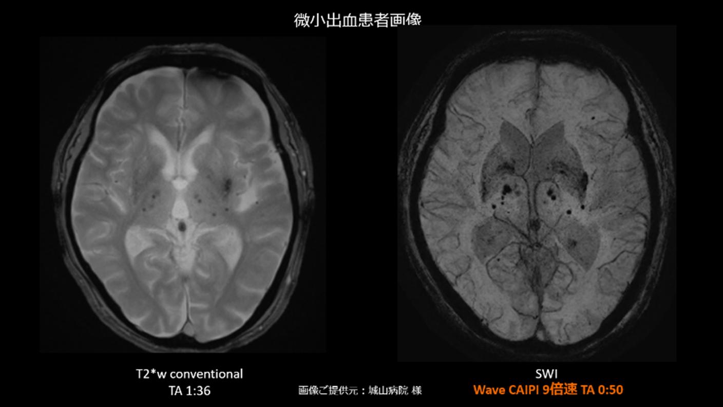 PR MAGNETOM Vida and Lumina Pro Edition clinical Neuro