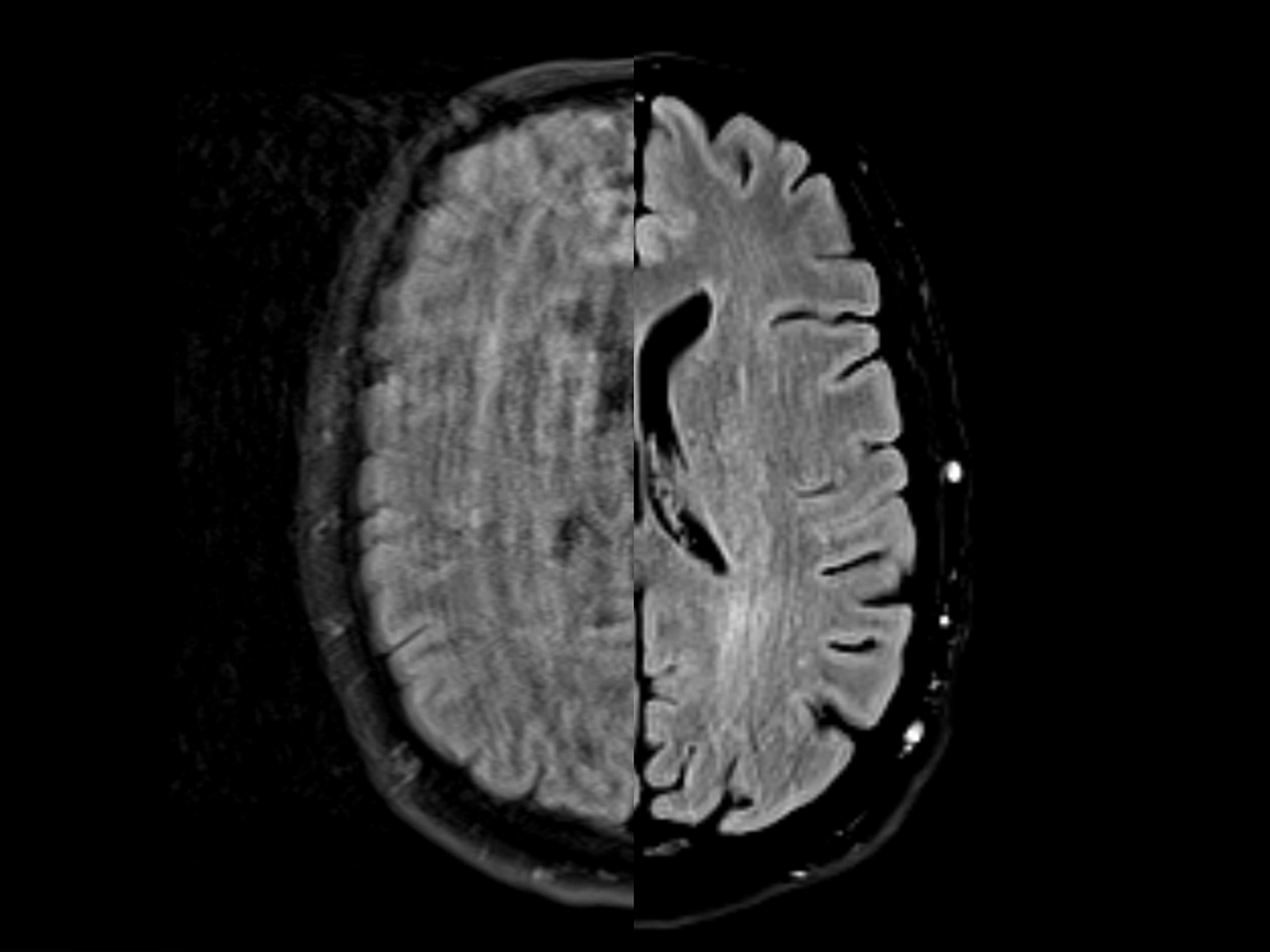 MRI scan using BioMatrix Technology
