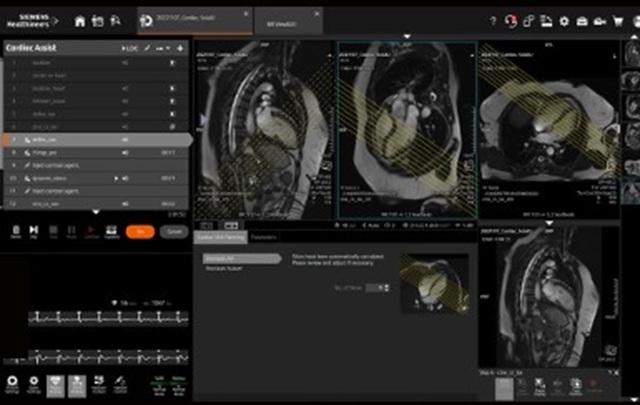 MR cardiac basis classroom training NL
