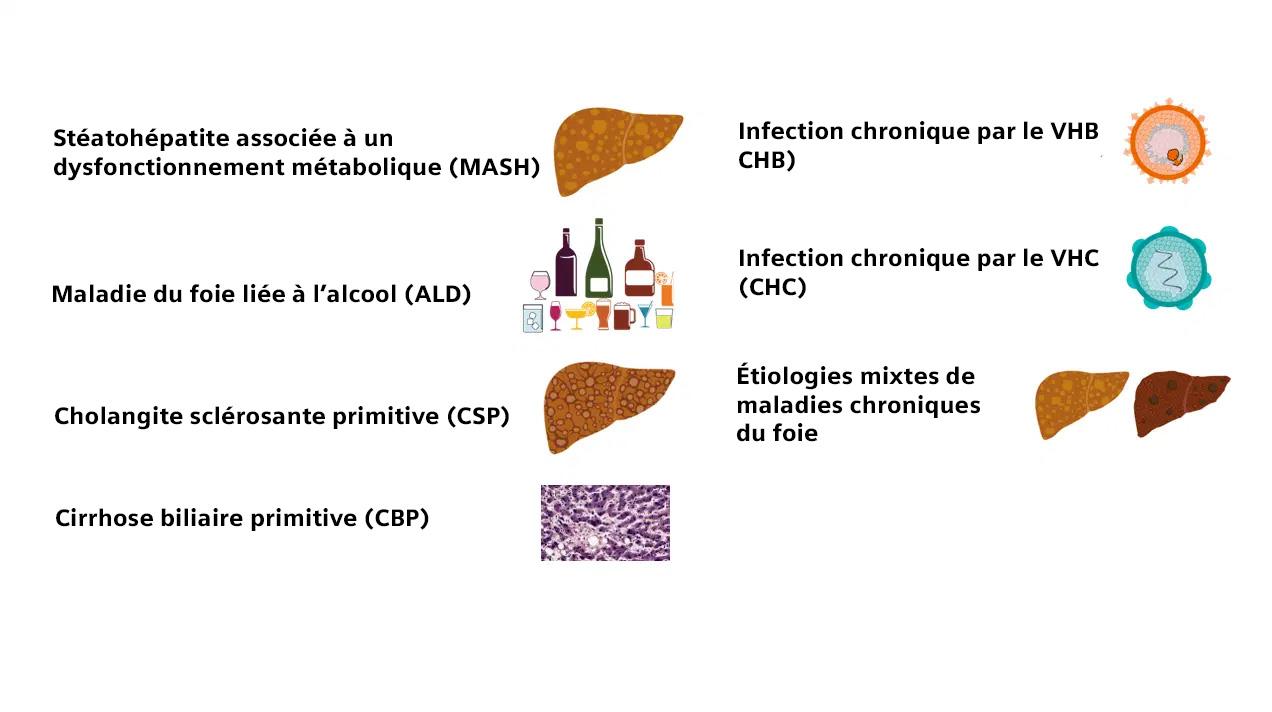 siemens-healthineers_DX_LS_ELF_Mixed-Etiologies_FR.