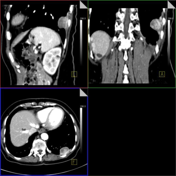 syngo Volume Perfusion CT Body