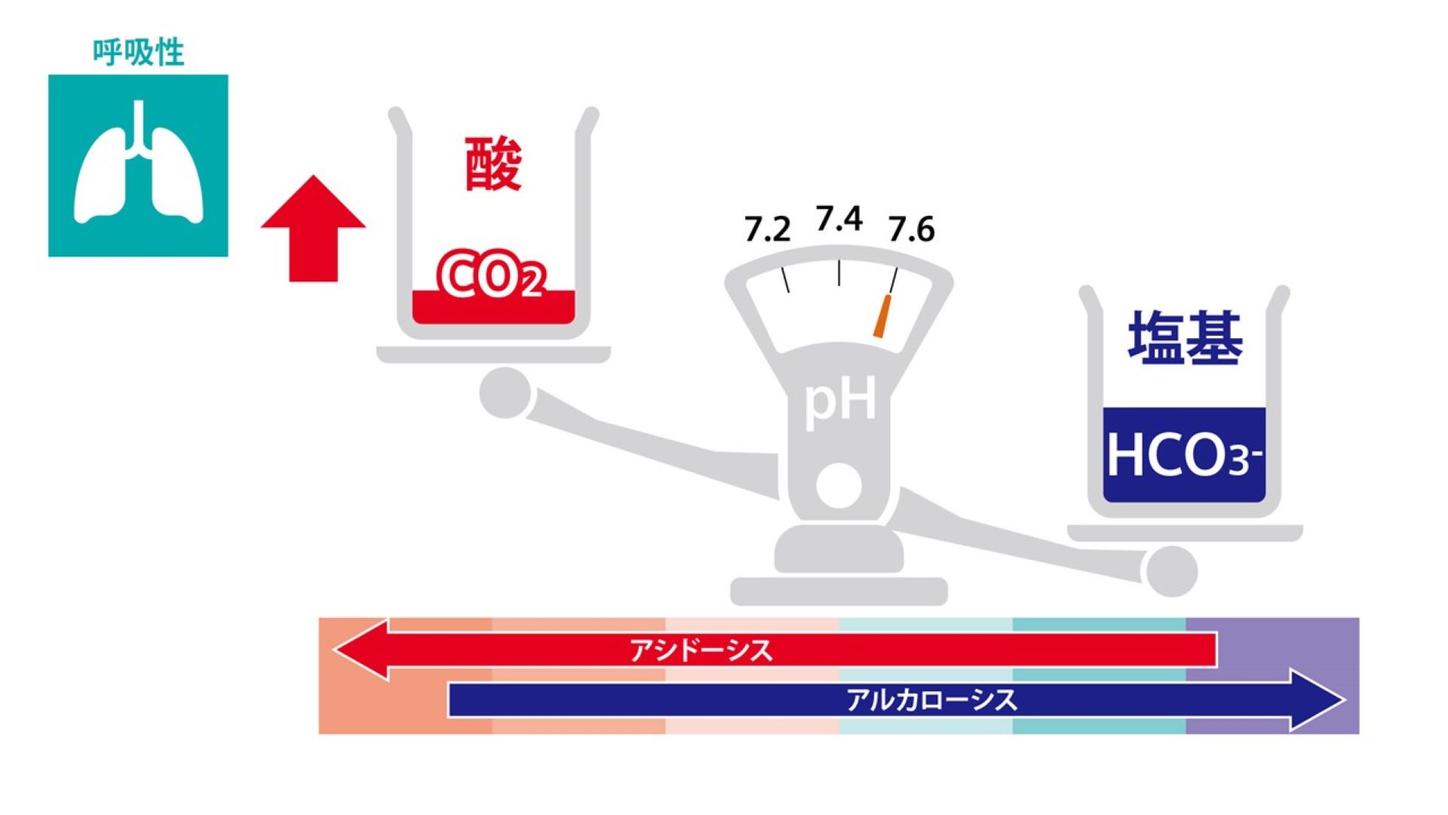 血液ガス分析かわら版⑥STEP2呼吸性アルカローシス